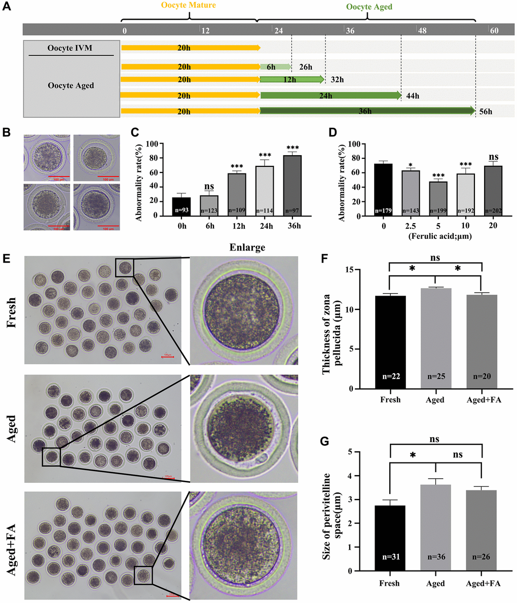 FA palliates aging-induced oocyte morphological anomalies. (A) Timeline diagram of in vitro-aged bovine oocytes. (B) Representative images of oocyte morphological anomalies (a very granular PVS, large PVS, first polar body degradation, and nonuniform cytoplasm). (C) The abnormality rates of in vitro aging for 6 h, 12 h, 24 h and 36 h groups. R = 4. (D) The abnormality rates of oocytes in vitro aged 12 h treated with different concentrations of FA (0, 2.5, 5, 10, or 20 μM). R = 7. (E) Representative images of PVS morphology in the Fresh, Aged, and Aged + FA groups. Scale bars: 100 μm. (F, G) Thickness of ZP and size of PVS of Fresh, Aged, Aged + FA groups. *P **P ***P 