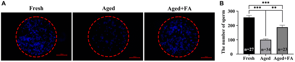 FA improves the sperm binding ability of aged oocytes. (A) Representative fluorescence images of sperm binding to the surface of the zona pellucida surrounding oocytes stained with Hoechst 33342 from the three groups (Fresh, Aged, and Aged + FA group). Scale bar: 100 μm. R = 3. (B) Number of sperm binding to the surface of the zona pellucida surrounding oocytes from the three groups (Fresh, Aged, and Aged + FA group). *P **P ***P 