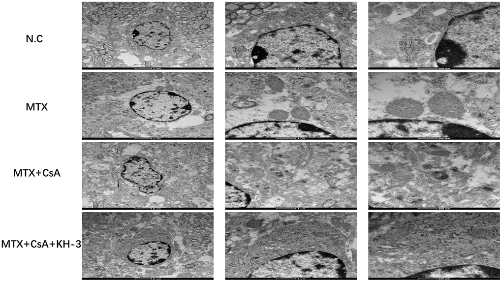 Ultrastructural mitochondrial changes in the hippocampus in different groups. Transmission electron microscopy images of hippocampal neuronal mitochondria from each group (scale bar = 2 um, 1 um and 500 nm from left to right, respectively).
