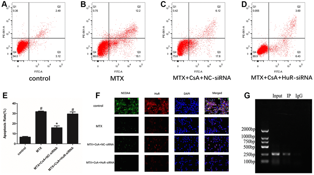 CsA alleviated neuronal apoptosis in MTX-excited HT22 cells through HuR. (A–D) Representative results on apoptotic cells in the Control, MTX, MTX+CsA+NC-siRNA, and MTX+CsA+HuR-siRNA groups, as evaluated using flow cytometry. (E) Flow cytometry analysis of HT22 cells in the Control, MTX, MTX+CsA+NC-siRNA, and MTX+CsA+HuR-siRNA groups. (n=3 per group). #p F) HT22 cell, as captured after co-staining with HuR and NCOA4. In the representative images, HuR and NCOA4 are shown in red and green, respectively. Representative micrographs: ×400 magnification. (G) HR22 cell lysis immunoprecipitation with anti-HuR antibody or control IgG.