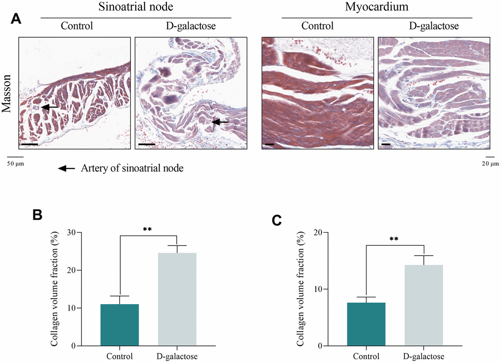 D-galactose causes fibrosis of sinoatrial node and myocardium. (A) Masson’s trichrome staining of sinoatrial node (Scale = 50 μm) and myocardium (Scale = 20 μm). (B) CVF of sinoatrial node. (C) CVF of myocardium. Black arrow represents the artery of sinoatrial node; ** represents P