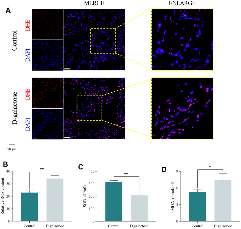 D-galactose induces oxidative stress in the sinoatrial node. (A, B) DHE staining results for the indicated groups. Scale = 50 μm. (C, D) SOD and MDA assay results for the indicated groups. * represents PP