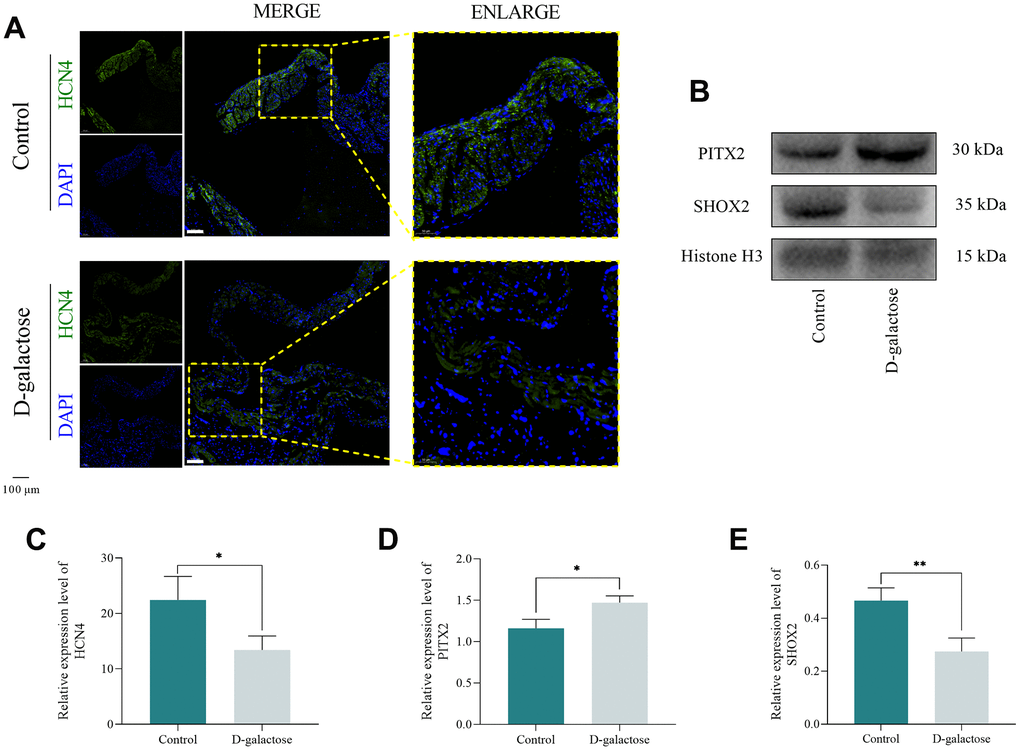 Oxidative stress causes If channel abnormality. (A) Immunofluorescence staining of the SAN. Scale = 100 μm. (B) Western blotting assay. (C) Results of immunofluorescence staining. (D, E) Results of Western blotting assay. * represents PP