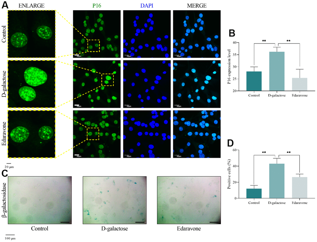 D-galactose causes cell senescence. (A, B) Results of P16 immunofluorescence staining. Scale = 20 μm. (C, D) Results of β-galactosidase staining. Scale = 100 μm. ** represents P