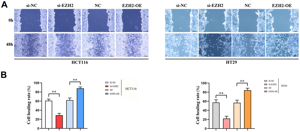 Cell scratch healing rate. (A) Cell scratch results plot for HT29 cells and HCT116 cells; (B) Data on cell healing rates of HT29 cells and HCT116 cells. (**P 