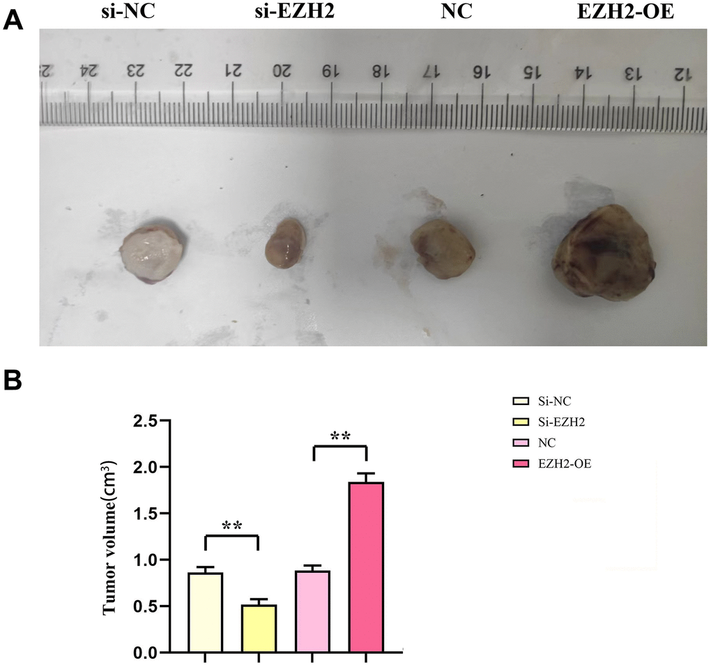 Effect of EZH2 on the development of colorectal cancer. (A) Chart of subcutaneous tumorigenesis test results in nude mice; (B) Statistics of subcutaneous tumorigenesis in nude mice. (**P 