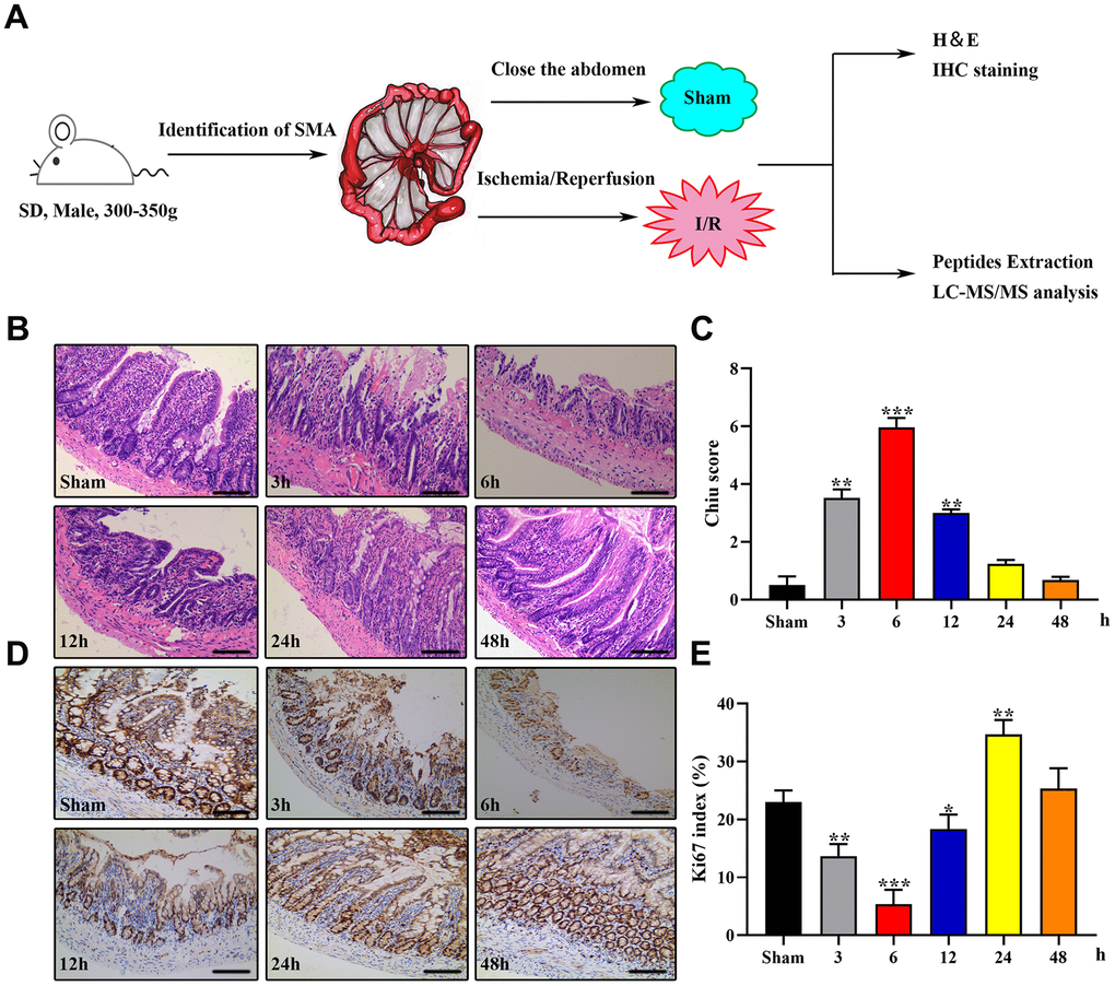 Establishment of the rat IIRI model. (A) Schematic diagram of the experimental design. (B–E) Representative images of intestinal sections from rats of the sham operated and I/R groups stained with H&E (B) or the IHC marker Ki67 (C), respectively, and quantified histopathologically based on Chiu’s score (D) or immunoreactive scores (E), respectively. *P P P 