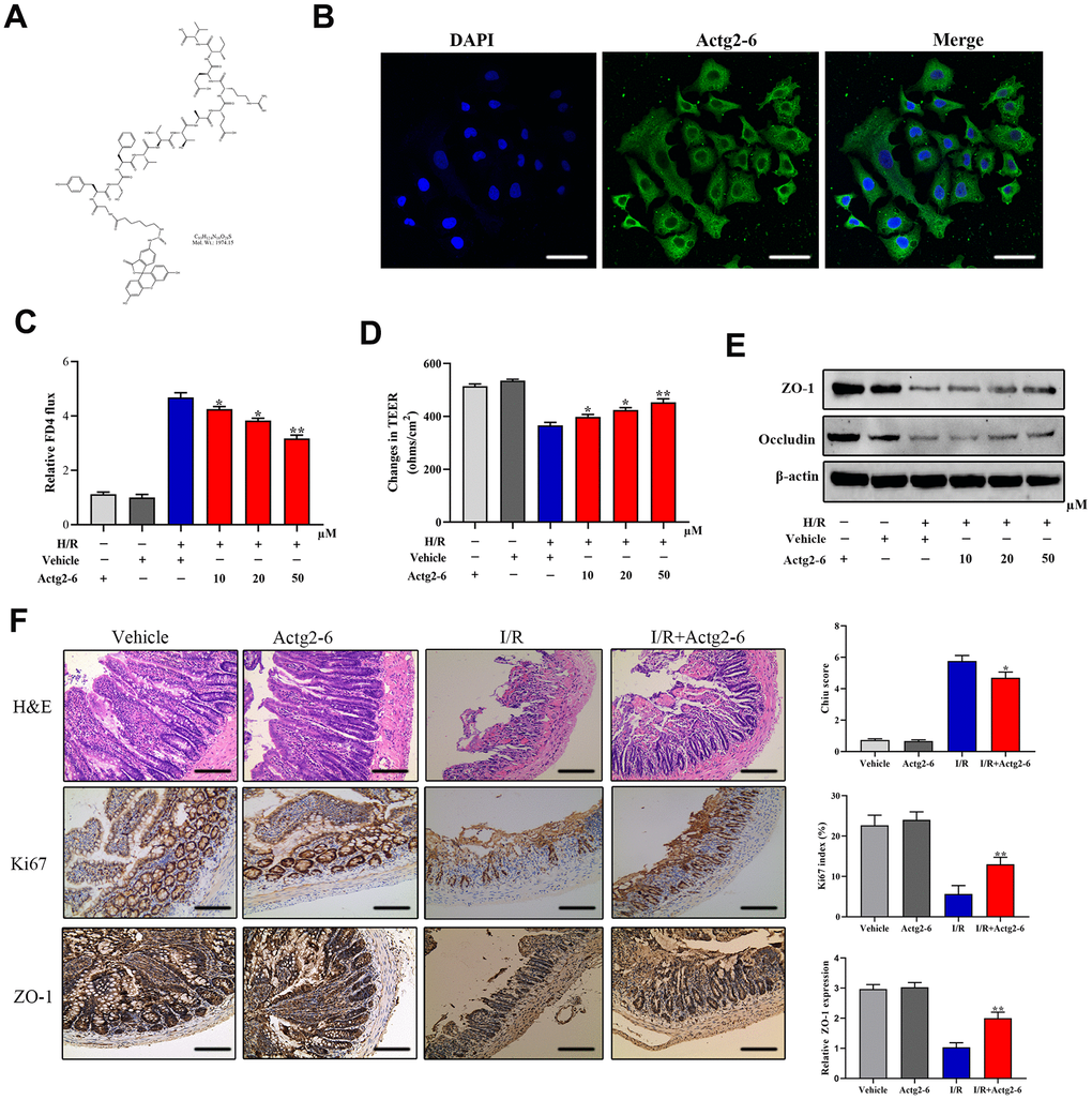 Effects of the candidate peptide Acg2-6 on intestinal mucosal barrier function. (A) Chemical formulas of Actg2-6. (B) Representative images of differentiated Caco-2 cells after incubation with Actg2-6. (C) Effect of Actg2-6 on intestinal epithelial permeability, as evaluated by the FITC-dextran paracellular permeability assay. (D) Effect of Actg2-6 on intestinal epithelial permeability, as evaluated by the TEER assay. (E) The proteins related with TJ proteins were detected by Western blotting. (F) Representative images of intestinal sections from rats of the sham operated and 1I/6R groups stained with H&E or the IHC marker Ki67 or ZO-1, respectively, and quantified histopathologically based on Chiu’s score or immunoreactive scores, respectively. *P P P 