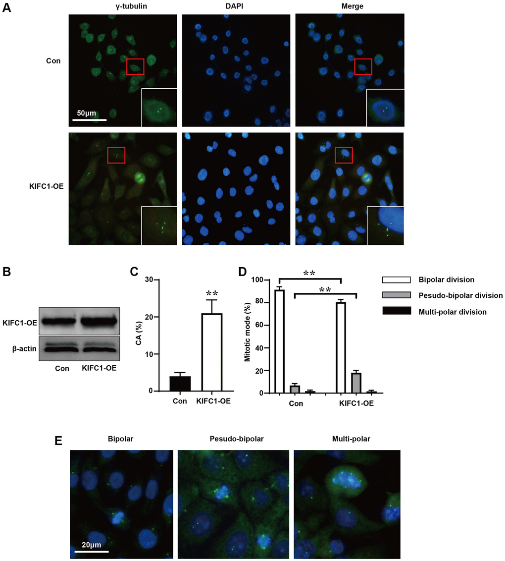 Overexpression of KIFC1 promotes centrosome amplification and pseudo-bipolar division. (A) Schematic illustration of centrosome amplification in KIFC1 overexpression group and control group, where centrosomes were labeled with gama-tubulin antibody (green) and DNA was stained with DAPI (blue); (B) Western blot analysis the overexpression of KIFC1; (C) Statistics of centrosome amplification rate in cells after KIFC1 overexpression; (D) Statistics of the ways cells enter mid and late stages of mitosis; (E) Schematic illustrations of bipolar division, pseudo-bipolar division, and multi-polar division in cells, where centrosomes were labeled with gama-tubulin antibody (green) and DNA was stained with DAPI (blue). n = 3, **