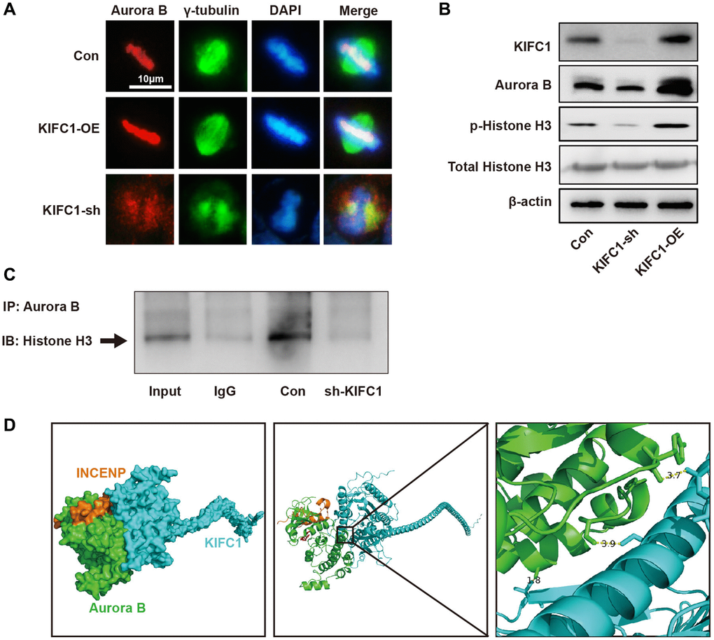 KIFC1 regulates the expression and subcellular localization of Aurora B. (A) The subcellular localization of Aurora B after overexpression and knockdown of KIFC1, where Aurora B is indicated in red, and gamma tubulin in green; (B) Protein levels of Aurora B and the expression and phosphorylation of its substrate Histone H3 after overexpression and knockdown of KIFC1; (C) co-IP detect the binding of Aurora B and Histone H3; (D) The molecular docking model of KIFC1 with Aurora B-INCENP complex.