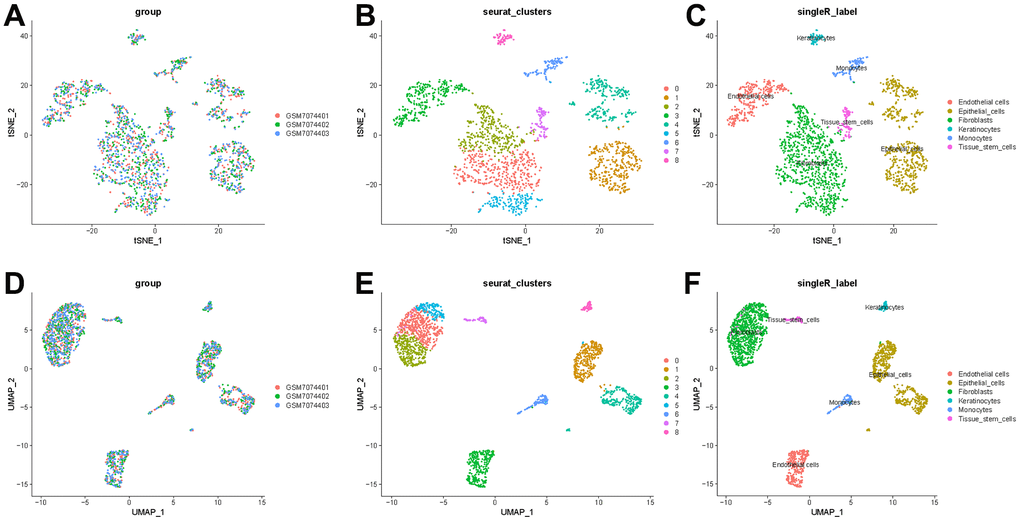 t-SNE and UMAP clustering of normal breast samples. (A) Inter-tumor heterogeneity of triple-negative breast cancer by t-SNE method. (B, C) Clusters and cell type annotations at the single-cell level in TNBC samples by t-SNE method. (D) Inter-tumor heterogeneity of triple-negative breast cancer by UMAP method. (E, F) Clusters and cell type annotations at the single-cell level in TNBC samples by UMAP method.