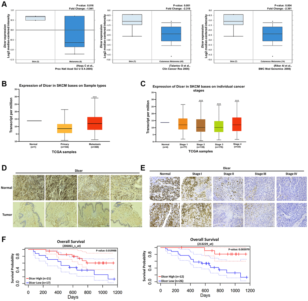 Clinical relevance of Dicer expression in patients with melanoma. (A) Levels of Dicer expression in melanoma tissues and normal skin tissues, measured using the Oncomine data set. Dicer expression was inversely correlated with (B) primary and metastatic melanoma tissues. (C) Association between Dicer expression and melanoma tumor stages. (D) IHC analysis of the levels of Dicer expression in normal skin tissues and melanoma tissues, (E) IHC analysis of the levels of Dicer expression in tissues sampled during various stages of melanoma. Scale bar: 500 μm. (F) Kaplan–Meier overall survival curves for the levels of Dicer expression in patients with melanoma.