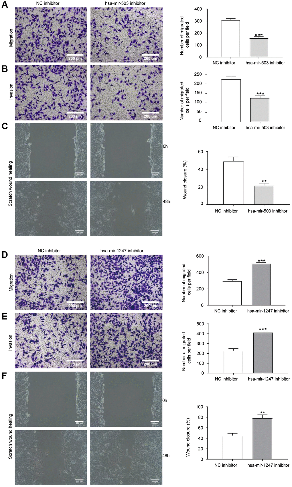 Effects of hsa-mir-503/hsa-mir-1247 knockdown on migration and invasion ability of 22RV1 cells. (A) The migratory ability of 22RV1 cells was significantly suppressed after hsa-mir-503 knockdown. (B) The invasive ability of 22RV1 cells was significantly suppressed after hsa-mir-503 knockdown. (C) Knockdown of hsa-mir-503 inhibited the lateral migration ability of 22RV1 cells. (D) The migratory ability of 22RV1 cells was significantly increased after hsa-mir-1247 knockdown. (E) The invasive ability of 22RV1 cells was significantly increased after hsa-mir-1247 knockdown. (F) Knockdown of hsa-mir-1247 promoted the lateral migration ability of 22RV1 cells (*p **p ***p 