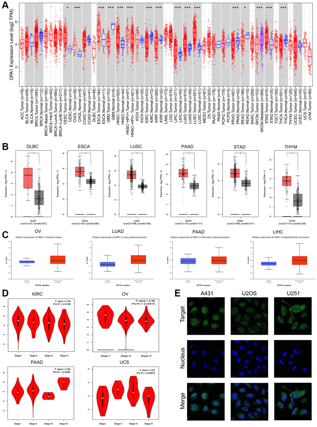 The expression levels of OPA1 in different tumors and normal samples. (A) The expression levels of the OPA1 gene in different tumors and paratumoral tissues were analyzed by TIMER2. *p **p ***p B) The expression levels of the OPA1 gene in DLBC, ESCA, LUSC, PAAD, STAD, THYM, and the normal samples, were analyzed by GEPIA. *p C) The protein expression of OPA1 in OV, LUAD, PAAD, LIHC, and the normal samples was analyzed by UALCAN. (D) The expression level of OPA1 in the different stages of KIRC, OV, PAAD, and UCS, was analyzed by GEPIA. (E) The immunofluorescence in osteosarcoma cell lines (A431, U2OS, and U251), was analyzed by HPA.