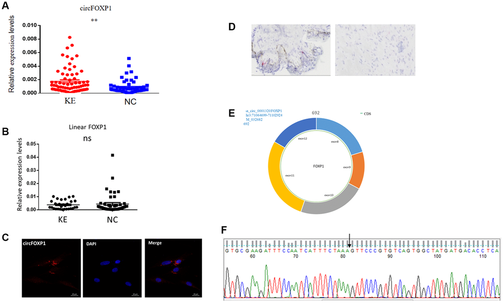 Expression levels and correlation analysis of has-circFoxp1 and linear Foxp1 mRNA in keloid tissues. (A) qRT-PCR analysis of relative RNA levels of circFoxp1 in keloid tissues and normal skin. (B) qRT-PCR analysis of relative RNA levels of Foxp1 in keloid tissues and normal skin. (C) FISH assay indicting the cellular location of circFoxp1 (red) in the HSFs (magnification 400× and scale bar 20 μm). Probe sequence: TGACACGGGAACTTTAGAAATGAT. (D) RNAscope assay indicating the cellular location of circFoxp1 (red) in Keloid tissues (magnification 100× and scale bar 100 μm). Most of the expression of circFoxp1 was located in the cytoplasm. (E) Map of circFoxp1 derived from the 8-12 exon region of the FOXP1 gene. (F) Sanger sequencing results indicating the cyclization site of circFoxp1 (arrow). **p 