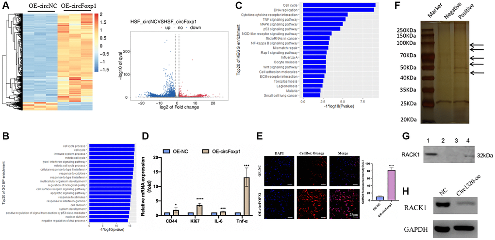 Gene expression profiling reveals an increase in genes associated with inflammation and RNA pull-down shows circFoxp1 interact with RACK1. (A) Heatmap and volcano plot showed the differentially expressed RNAs in paired samples of HSFs by RNA-seq analysis. Fold change > 1 or P value B) GO annotations of the genes of upregulated expressed RNAs. The bar plot presented the enrichment scores (−loge [p value]) of the top 20 significantly enriched GO terms in biological processes, cellular components and molecular functions. (C) Bulb map of KEGG analysis for the genes of upregulated expressed RNAs. Rich factor represented the enrichment degree of differentially expressed genes. Y axis showed the name of enriched pathways. The area of each node represented the number of the enriched host genes of differentially expressed RNAs. The p-value was represented by a color scale. (D) Quantitative RT-PCR to quantify fibroblast migration marker (CD44), proliferation marker (Ki67) and inflammation cells marker (IL-6 and TNF-α) circFoxp1 overexpressed HSF cells. *P ***P E) ROS activity was determined by confocal fluorescence microscopy using CellROXTM Deep Orange Staining. Scale bar: 25 μm. ****P F) RNA pulls down revealed several proteins interact with circFoxp1. (G) Western blot confirmed ROCK1 presented in RNA pulldown liquid. (H) ROCK1 reduced in the OE-circFoxp1 group as compared to OE-Ctr in HSFs.