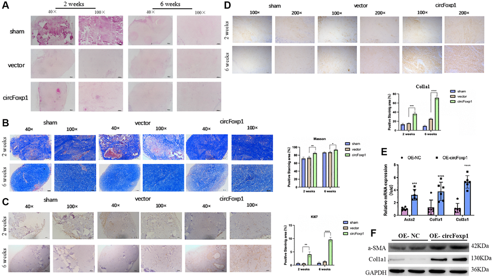 Overexpression of circFoxp1 enhances the growth of keloid and ECM deposition in vivo. (A) Representative images of HE staining and (B) Masson staining of keloid nodules in different intervention groups. (magnification, 100× and magnification, 200×). (C) Relative expression level of Ki67 and (D) Col1a1 observed in keloid grafts by IHC. (magnification, 200× and magnification, 400×). *P **P ***P ****P E) Quantitative RT-PCR (n = 6) showing transcript expression of related markers of ECM upregulated compared with the OE-NC of HSFs. (F) Western blot (n = 3) showing protein expression of related markers of ECM synthesis upregulated compared with the OE-NC of HSFs.