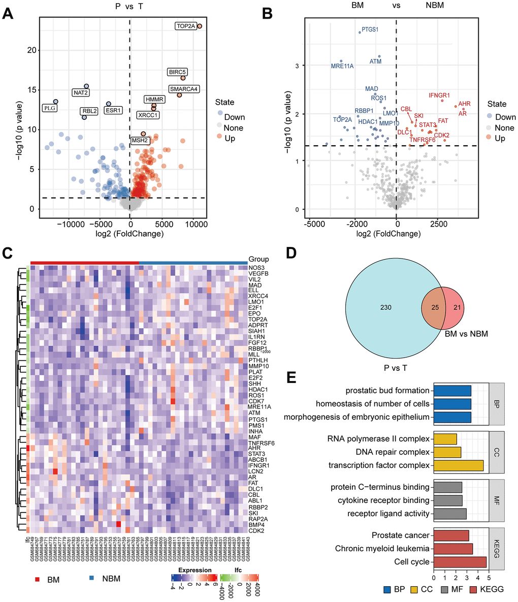 TOP2A is associated with bone metastasis of liver hepatocellular carcinoma. (A) Volcano plot of differentially expressed genes (DEGs) between LIHC and paracancerous tissues from GSE27635 database, red indicated up-regulated genes, and blue indicated down-regulated genes. (B) Volcano plot of DEGs between LIHC with BM and NBM. (C) Heatmap of DEGs between LIHC with and without BM. (D) Venn diagram of DEGs from A and B. (E) GO and KEGG enrichment analysis of the above overlapping genes. P, peritumor; T, tumor; BM, bone metastasis; NBM, non-bone metastasis.