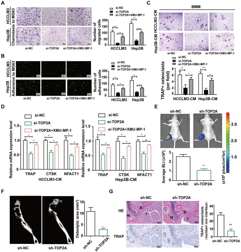 TOP2A enhances bone-specific metastatic potential and tumor-induced osteolysis in the bone microenvironment. (A) Chemotactic migration of HCCLM3 and Hep3B cells toward MG63 cells was evaluated by transwell assays. (B) The adhesion ability of HCCLM3 and Hep3B cells to MG63 cells was assessed by heterogeneous cell-cell adhesion assay. (C) TRAP staining of bone marrow monocyte (BMM) cells treated with conditioned medium (CM) from HCCLM3 and Hep3B cells. Scale bar, 200 μM. Quantification of TRAP+ osteoclast number. (D) qRT-PCR verified the expression of TRAP, CTSK, and NFACT1 in the indicated groups of BMM cells. GAPDH as the loading control. (E) 2.5×105 control or TOP2A knockdown HCCLM3 and Hep3B cells were injected directly into the tibias of the mice. Representative bioluminescent images taken on day 28 after inoculation are shown. (F) Representative micro-CT images of tibia osteolytic lesions. (G) H&E and TRAP staining of tibia lesions of mice. Quantification of TRAP+ osteoclasts. Scale bar, 100 μm. *P P 