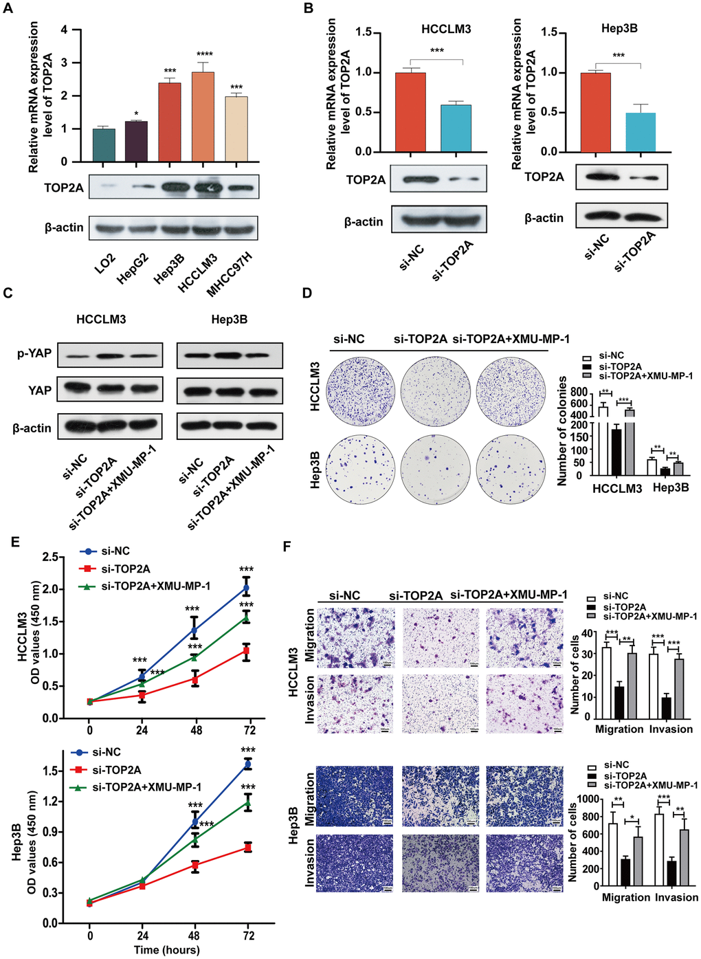 Hippo-YAP signal pathway mediates TOP2A-driven LIHC cell growth, migration, and invasion. (A) The expression of TOP2A was detected by qRT-PCR and Western blot in normal liver cell line and four liver cancer cell lines. (B) The knockdown efficiency of TOP2A siRNA was determined by qRT-PCR and Western blot in HCCLM3 and Hep3B cells. (C) The expression level of p-YAP and YAP was detected by Western blot in the indicated groups of HCCLM3 and Hep3B cells. β-actin was used as a control. (D, E) the effect of TOP2A on cell proliferation was assessed by colony formation and CCK8 assays in HCCLM3 and Hep3B cells. (F) The effect of the TOP2A on cell migration and invasion was tested by transwell assays in HCCLM3 and Hep3B cells. *P P P 