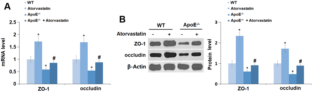 Atorvastatin restored the expression of tight junction proteins in the cortex of aged ApoE-/- mice. (A) mRNA of ZO-1 and occludin was measured by RT-PCR; (B) Protein of ZO-1 and occludin was measured using immunostaining (*, P-/- mice group).