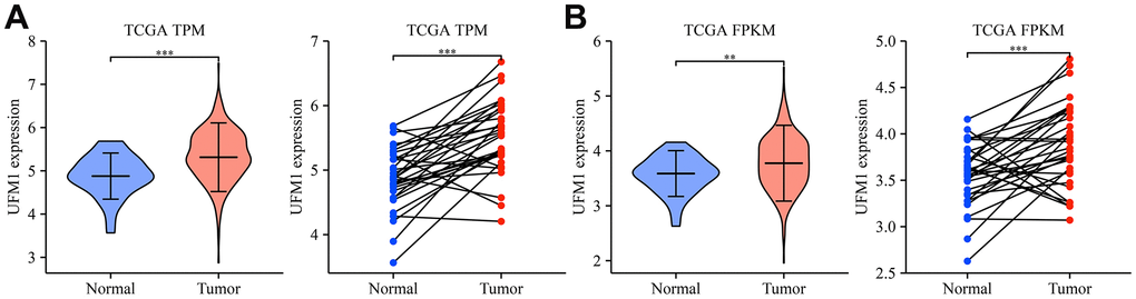 UFM1 expression significantly increased in OSCC tissues of the TCGA database. (A) The data of TPM type in TCGA database; (B) The data of FPKM type in TCGA database. Note: OSCC, oral squamous cell carcinoma; TCGA, The Cancer Genome Atlas; FPKM, reads per kilobase of transcript per million reads mapped; TPM, transcripts per million.