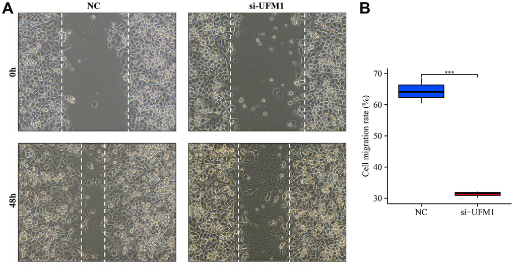 Inhibition of UFM1 expression significantly reduces cell migration. (A) Wound healing of cancer cells; (B) Cell migration rate in si-UFM1 vs. NC groups.