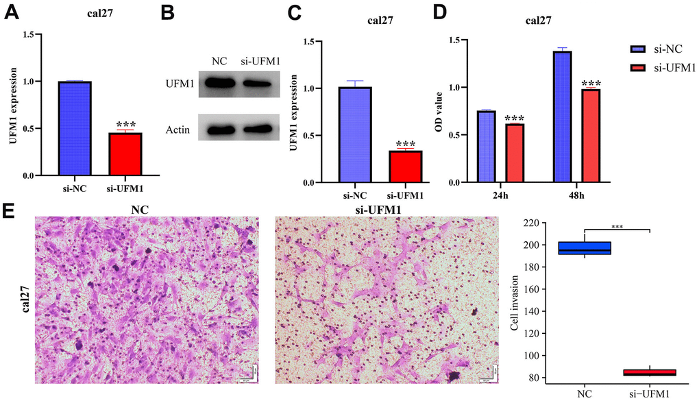 Inhibiting UFM1 expression significantly reduces cell proliferation and invasion via CCK-8 and Transwell. (A–C) Establishment of cell model; (D) Cell proliferation; (E) Cell invasion.