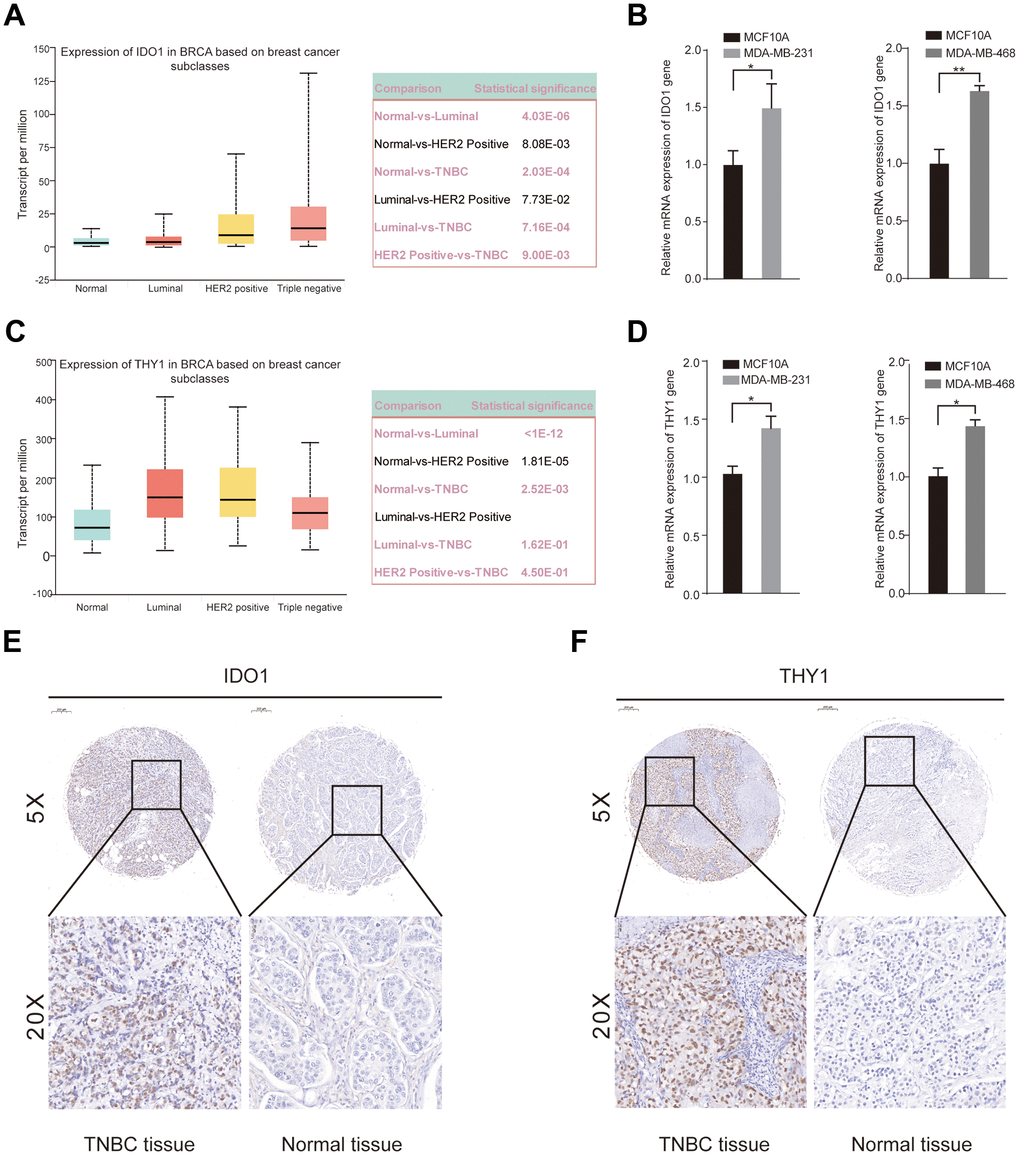 Upregulated expression of IDO1 and THY1 in TNBC cell lines and tissue samples. (A) Significantly different expression of the IDO1 among breast cancer tissues and normal tissues. (B) qRT-PCR examined the mRNA expression of IDO1 gene in MCF-10A, MDA-MB-231, and MDA-MB-468 cell lines. (C) Significantly different expression of the THY1 gene between breast cancer tissues and normal tissues. (D) qRT-PCR examined the mRNA expression of THY1 gene in MCF-10A, MDA-MB-231, and MDA-MB-468 cell lines. (E, F) IHC staining of IDO1 and THY1 protein in adjacent normal tissues and TNBC tissues. (*P