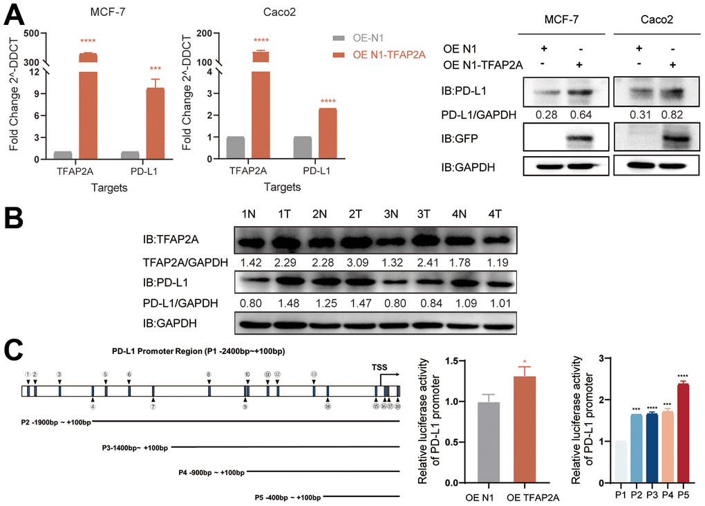 Experimental validation of the role of TFAP2A in BRCA and COAD. (A) RT-qPGR and Western blot analysis of the PD-L1 mRNA and protein levels, respectively, were determined in MCF-7 and Caco2 cells with TFAP2A overexpression; (B) TFAP2A protein levels in fresh colon cancer tissue (T) and adjacent normal samples (N) (4 pairs) detected by Western blot; (C) Schematic diagram showed the predicted binding site of TFAP2A on PD-L1 promoter and truncated PD-L1 promoter constructs. Relative luciferase activity in HEK-293FT cells co-transfected with the PD-L1 promoter and TFAP2A OE plasmid. *p 