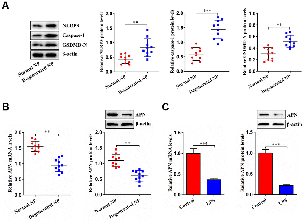 Decreased APN expression in degenerated NP tissue and LPS-treated human NP cells. (A) Western blot was used to determine the protein levels of NLRP3, caspase-1 and GSDMD-N in normal and degenerated human NP tissue samples (n=10). (B) The qRT-PCR and western blot analyses of APN expression in normal and degenerated human NP tissue samples (n=10). (C) Human NP cells were treated with PBS or LPS for 12 h, followed by measurement of APN expression using qRT-PCR and western blot (n=3). Data are expressed as mean ± SD. **P P 