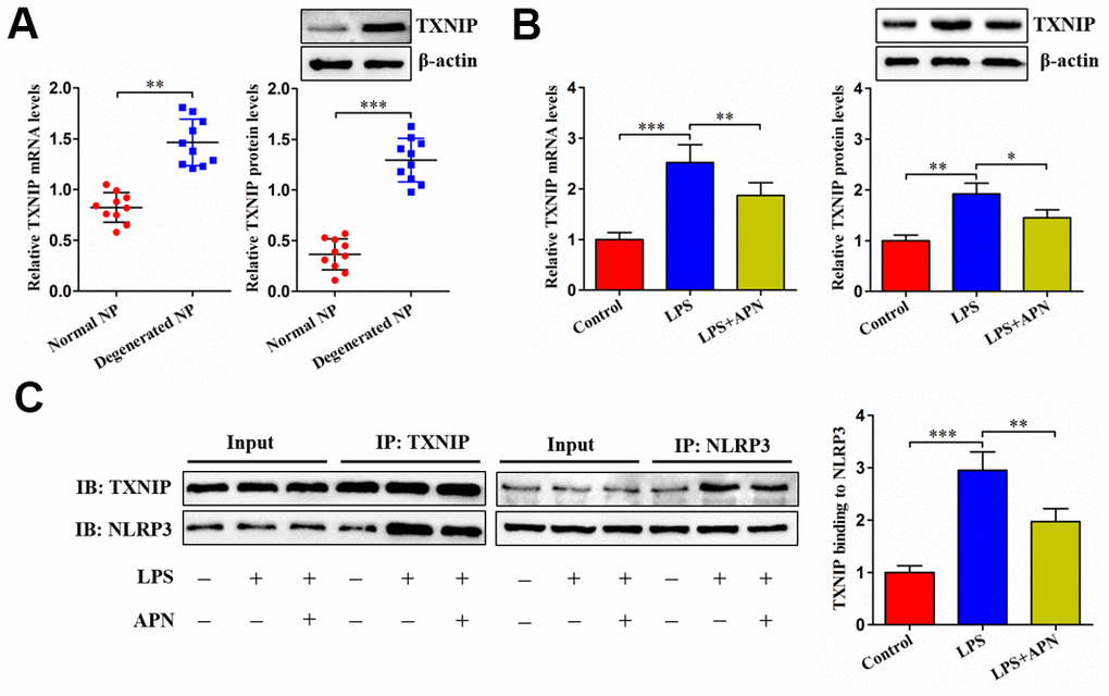 Effects of APN on TXNIP expression and its interaction with NLRP3. (A) TXNIP expression was assayed by qRT-PCR and western blot in normal and degenerated human NP tissue samples (n=10). (B, C) After 12 h of treatment with PBS or LPS, human NP cells were transfected with or without lentiviral vector expressing APN for 24 h (n=3). (B) TXNIP expression was evaluated by qRT-PCR and western blot. (C) Co-IP analysis of TXNIP interaction with NLRP3. All results are expressed as the mean ± SD. *P P P 