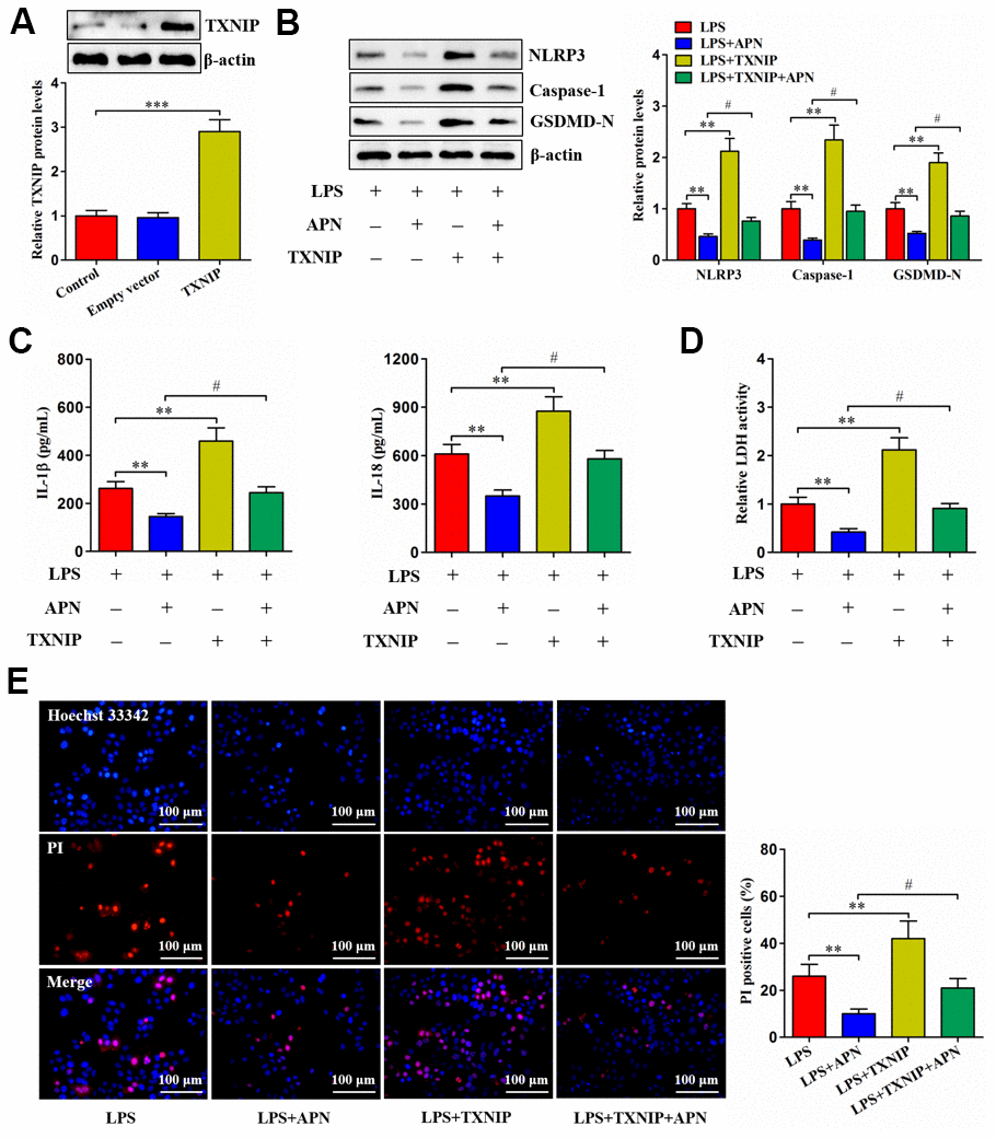 Involvement of TXNIP in APN-inhibited human NP cell pyroptosis. (A) Human NP cells were treated with PBS, empty vector or lentiviral vector expressing TXNIP for 24 h, followed by western blot analysis of TXNIP protein. (B–E) Human NP cells were transfected with APN and/or TXNIP by lentiviral vector in the presence of LPS. (B) Cell lysates were immunoblotted with indicated antibodies. (C) The levels of IL-1β and IL-18 were detected using ELISA in the cell culture supernatants. (D) The LDH assay kit was employed to measure LDH activity in the cell culture supernatants. (E) Representative images of fluorescent staining with Hoechst 33342 (blue) and PI (red). PI positive cells were quantified. Data shown are mean ± SD from three independent experiments. *P P P 