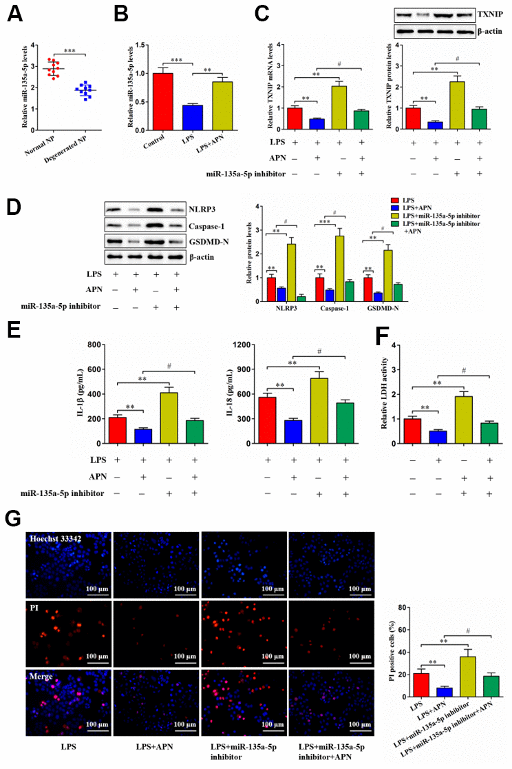 APN suppresses human NP cell pyroptosis by up-regulating miR-135a-5p expression. (A) Detection of miR-135a-5p expression in normal and degenerated human NP tissue samples using qRT-PCR (n=10). (B) Human NP cells were treated with PBS or LPS for 12 h and then transfected with or without lentiviral vector overexpressing APN for an additional 24 h. The expression of miR-135a-5p was analyzed by qRT-PCR (n=3). (C–G) LPS-stimulated human NP cells were transfected with or without miR-135a-5p inhibitor for 24 h, followed by transduction with APN-expressing lentivirus for another 24 h (n=3). (C) TXNIP expression was measured using qRT-PCR and western blot. (D) Western blot was applied to determine the protein levels of NLRP3, caspase-1 and GSDMD-N. (E) Detection of IL-1β and IL-18 levels in the cell culture supernatants using ELISA. (F) The LDH assay kit was utilized to detect LDH activity in the cell culture supernatants. (G) Representative images of fluorescent staining with Hoechst 33342 (blue) and PI (red) and quantitative analysis of PI positive cells. The results are shown as the mean ± SD. **P P #P 