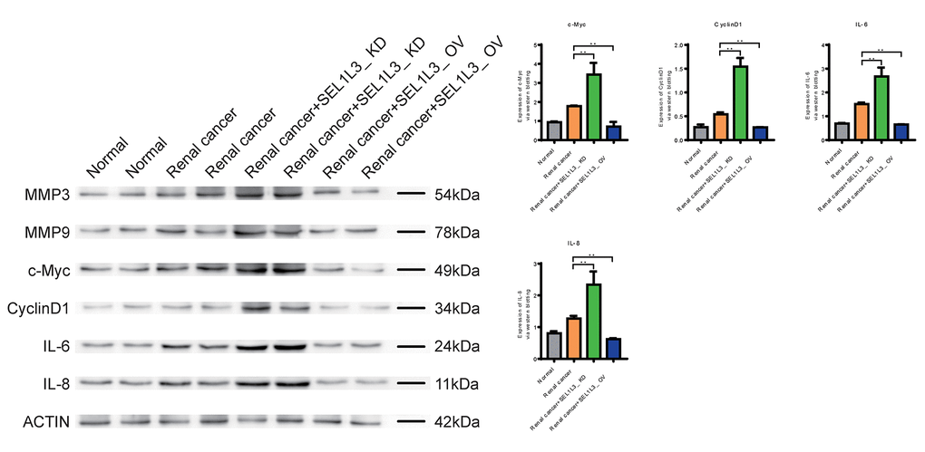 Experimental investigation into the impact of SEL1L3 on invasion, cell cycle and inflammation function.