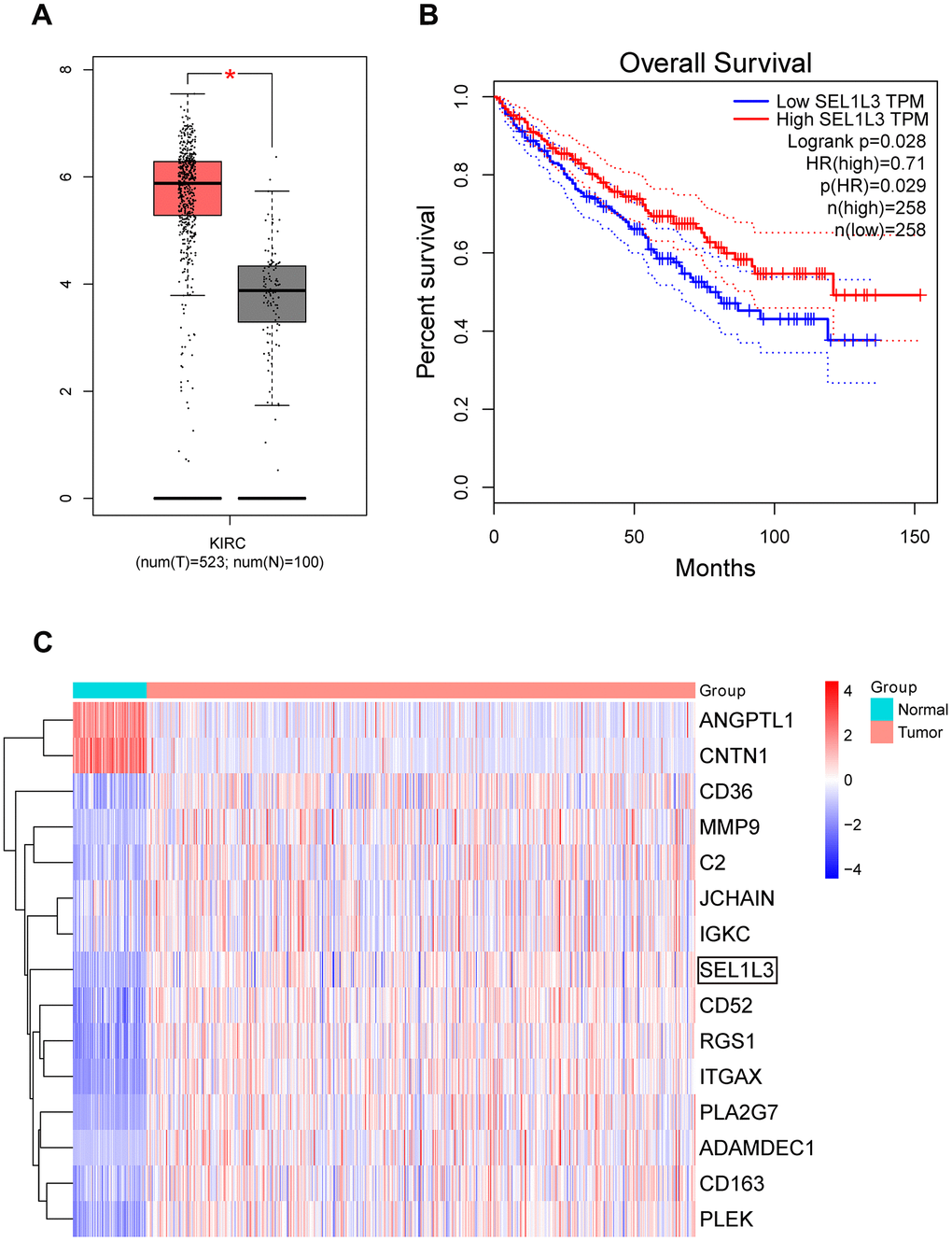 (A) Expression box plot of SEL1L3 in TCGA KIRC dataset. (B) Survival curve of SEL1L3 in KIRC dataset. (C) Heatmap of DEGs.