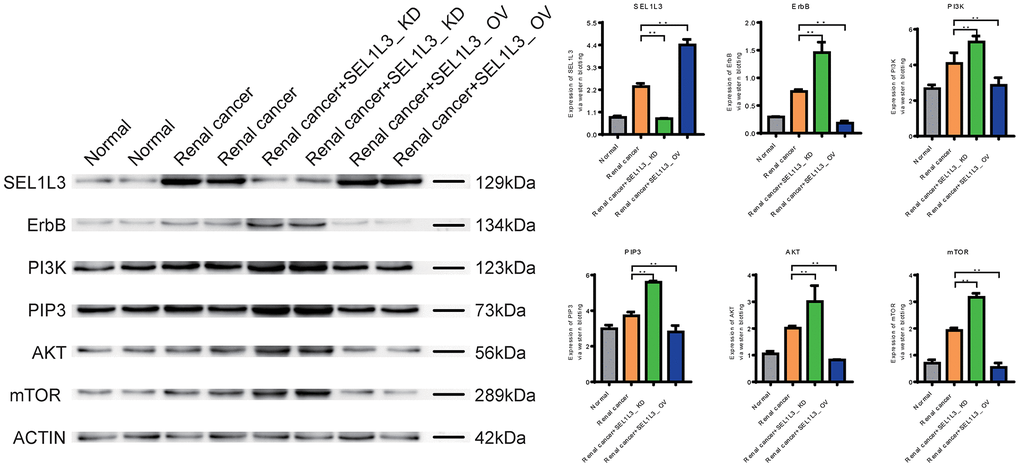 Experimental investigation into the impact of SEL1L3 on the ErbB/PI3K/mTOR signaling pathway.