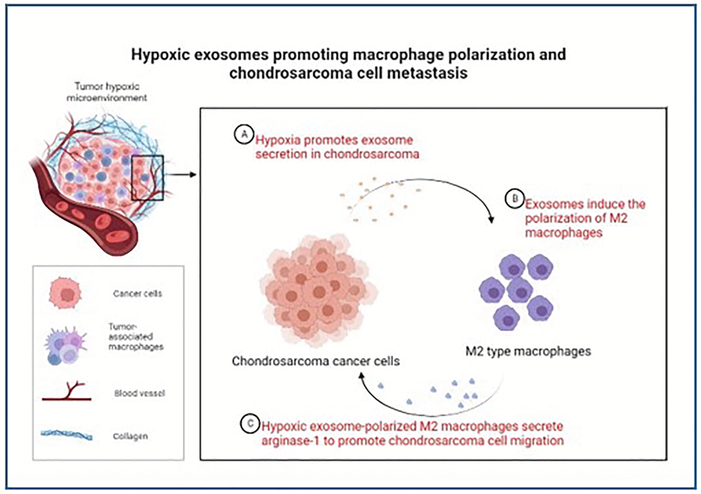 Schematic model of hypoxic exosomes promoting macrophage polarization and chondrosarcoma cell metastasis. Chondrosarcoma cell-derived hypoxic exosomes mediate macrophage M2 polarization and thereby facilitate the migration of chondrosarcoma cells.