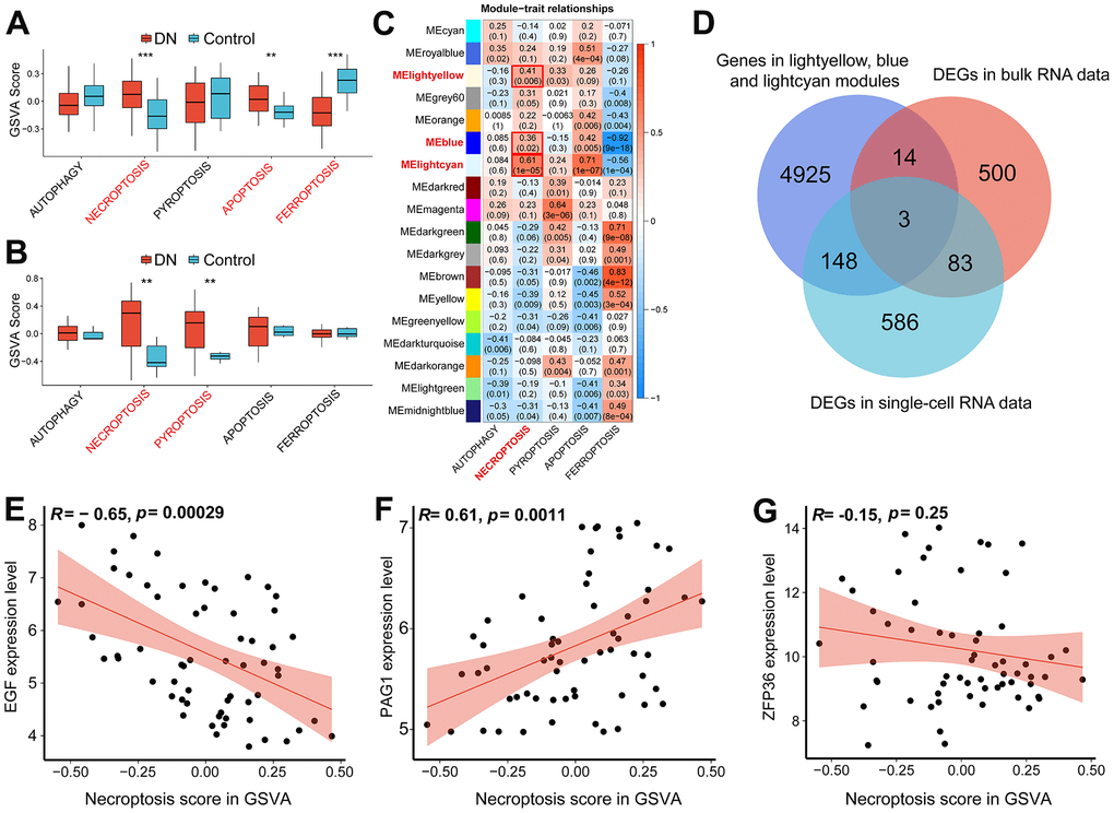 The identification of necroptosis-related biomarkers. (A) GSVA score of five different types of programmed cell death (PCD) in the bulk RNA-seq data (GSE96804). (B) GSVA score of five different types of programmed cell death based on the scRNA-seq data (GSE131882). (C) Heatmap showing the correlation between PCD traits and gene modules. (D) Venn diagram demonstrating the necroptosis-related biomarkers by intersecting necroptotic gene modules arising from WGCNA analysis, DEGs in the bulk RNA-seq data and DEGs in the scRNA-seq data. Scatter plots showing Pearson’s correlation analysis between necroptotic GSVA scores and EGF (E), PAG1 (F) and ZFP36 (G) respectively. (**P
