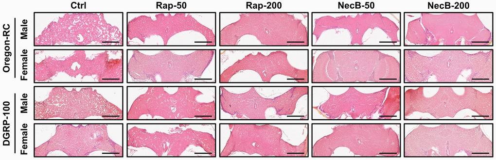 NecB inhibited age-related neurodegeneration in D. melanogaster’s brain morphology. Ctrl represents standard cornmeal medium; Rap-50 represents cornmeal medium supplemented with Rapamycin at 50 μg/mL; Rap-200 represents cornmeal medium supplemented with Rapamycin at 200 μg/mL; NecB-50 represents cornmeal medium supplemented with NecB at 50 μg/mL; and NecB-200 represents cornmeal medium supplemented with NecB at 200 μg/mL (Supplementary Table 1). A histological analysis was performed by H&E staining to examine the neurodegeneration of the Drosophila brains at the 90th days post-eclosion. n = 100; scale bars: 100 μm.