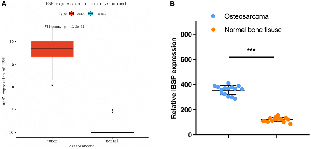 Expression of IBSP in osteosarcoma and normal tissue. (A) TARGET database analysis. (B) Validation in our collected 15 osteosarcoma and normal bone tissues. ***P 