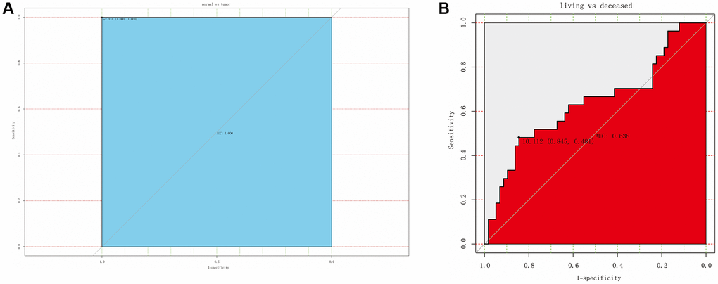 ROC curve for assessing the diagnostic ability of IBSP expression. (A) The diagnostic value of IBSP in osteosarcoma. (B) The diagnostic value of IBSP for living vs. deceased patients.