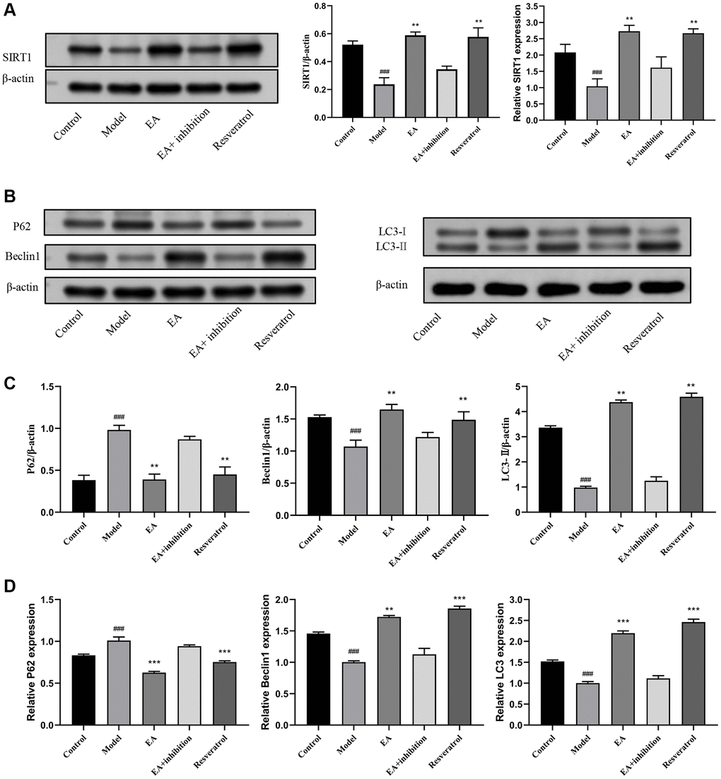 EA promotes SIRT1 expression and autophagy. (A) Western blotting and RT-qPCR and evaluation of SIRT1 expression in colon tissues. (B) Representative Western blotting graphs showing the expression of P62, Beclin1, and LC3 in colon tissues. (C) Quantitation of the expression contents of P62, Beclin1, and LC3. (D) RT-qPCR evaluation of the expression of P62, Beclin1 and LC3. Data are presented as mean ± SD (n = 8). #p ##p ###p *p **p ***p 
