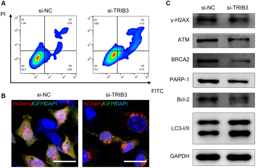 The role of TRIB3 in tumor development in renal cancer. (A, B) Apoptosis and autophagy level of A498 cells with si-NC or si-TRIB3 transfection. (C) Protein expression of γ-H2AX, ATM, BRCA2, PARP-1, Bcl-2 and LC3I/II in A498 cells with si-NC or si-TRIB3 transfection.
