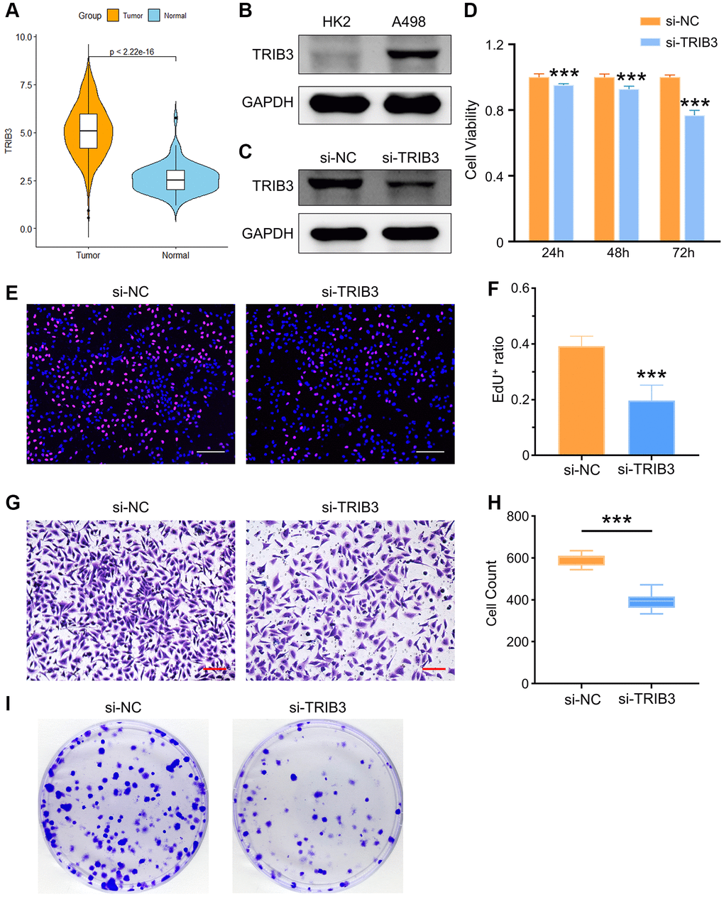 The role of TRIB3 in tumor development in renal cancer. (A) TRIB3 expression in TCGA-KIRC database. (B) TRIB3 expression in HK2 and A498 cells. (C) The efficacy of TRIB3 knockdown in A498 cells. (D) Cell viability of si-NC- or si-TRIB3-transfected A498 cells. (E) Proliferation ability of si-NC- or si-TRIB3-transfected A498 cells tested by EdU staining (scale bar = 200 μm), and the quantified data are shown in (F). (G, H) Invasion capacity of si-NC- or si-TRIB3-transfected A498 cells tested by Transwell assay (scale bar = 200 μm) and the quantified data. (I) Cloning assay of A498 cells with si-NC or si-TRIB3 transfection.