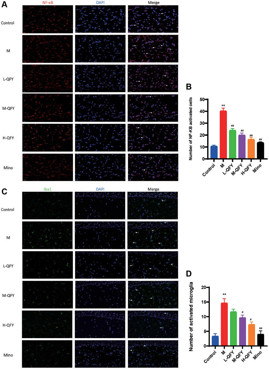 QFY reduces microglial activation and intracellular NF-κB activation in the hippocampus of AD rats. (A) The expression of NF-κB (red) in the hippocampus of AD rats. Fluorescence (×630). (B) Statistical analysis of data for the expression of NF-κB. (C) The expression of Iba1 (green) in the hippocampus of AD rats. Fluorescence (×400). (D) Statistical analysis of data for the expression of Iba1. N = 3 animals/group. The data are expressed as the means ± SDs. *p **p #P ##P 