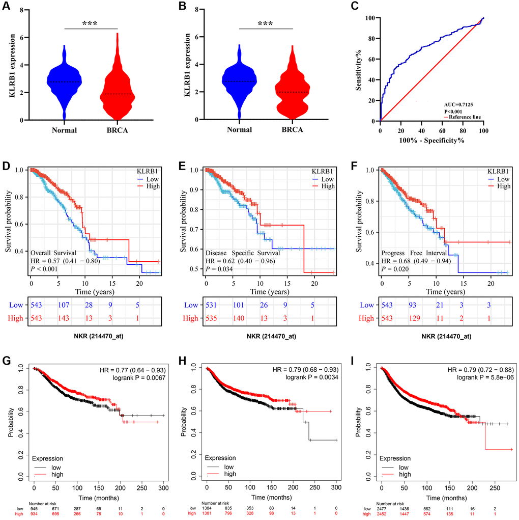 Increased KLRB1 levels were associated with diagnosis and better prognosis in BRCA using TCGA and K-M plotter databases. (A) KLRB1 expression in unpaired tissues; (B) KLRB1 expression in paired tissues; (C) The diagnostic effect of KLRB1 using ROC analysis; (D–F) The better prognosis related the KLRB1 overexpression in TCGA database by using K-M analysis; (G–I) Increased KLRB1 expression was associated with better OS, DMFS, and RFS of BRCA patients in K-M plotter database. Abbreviations: OS: overall survival; DMFS: distant metastasis-free survival; RFS: recurrence-free survival; ROC: Receiver operating characteristic; K-M: Kaplan-Meier.