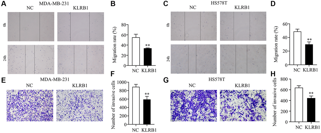 Overexpression of KLRB1 inhibited migration and invasion of breast cancer cells. (A–D) The migration of MDA-MB-231 and HS578T cells; (E–H) The invasion of MDA-MB-231 and HS578T cells.