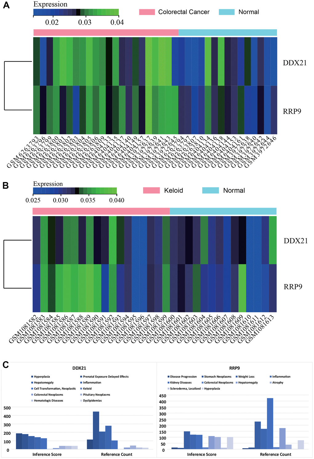Gene expression heat map. (A) colorectal cancer. (B) keloids. (C) CTD analysis, Core genes (RRP9, DDX21) were found to be associated with hyperplasia, keloid, colorectal tumor, scleroderma, and inflammation.