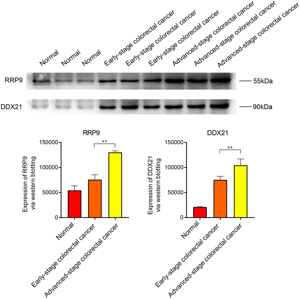 WB experiments. Expression levels of RRP9 and DDX21 in colorectal cancer.